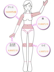 ひじ上・腹・手の甲（指も含む）・ひざ